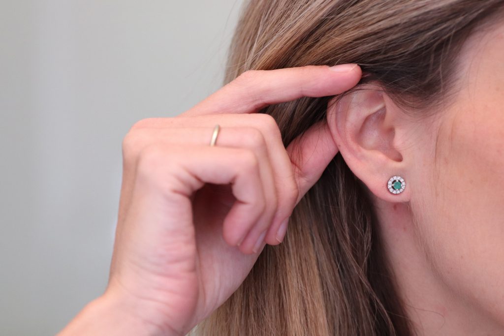 La guía definitiva sobre la otoplastia